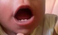 Apressada, Chloe nasceu antes do tempo e com dois dentinhos