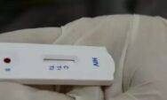 Pessoas com HIV voltam a ter direito &agrave; aposentadoria por incapacidade