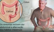 C&acirc;ncer colorretal: o tumor silencioso que agora atinge cada vez mais brasileiros com menos de 50 ano