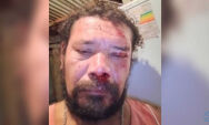 'Estou todo dolorido', diz homem atacado por on&ccedil;a ao tentar defender cachorro em Corumb&aacute;
