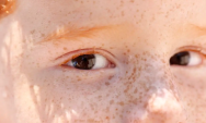 Leucocoria: Reflexo branco nos olhos de beb&ecirc;s pode indicar problemas graves e requer exame imediato
