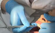 SUS garante atendimento odontol&oacute;gico gratuito e amplia servi&ccedil;os em Mato Grosso do Sul