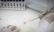 Secretaria de Sa&uacute;de de SP investiga novo caso suspeito de ebola