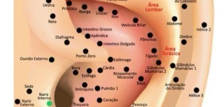 Auriculoterapia em Coxim: Pequenos Pontos, Grandes Resultados