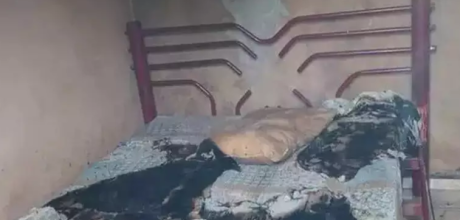 Adolescente queimado enquanto dormia com a namorada morre sete meses ap&oacute;s ataque
