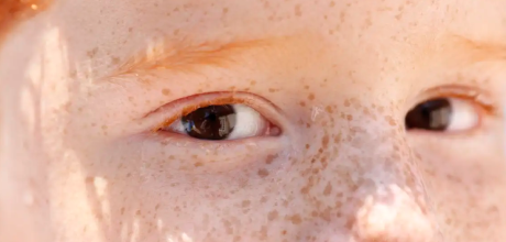 Leucocoria: Reflexo branco nos olhos de beb&ecirc;s pode indicar problemas graves e requer exame imediato
