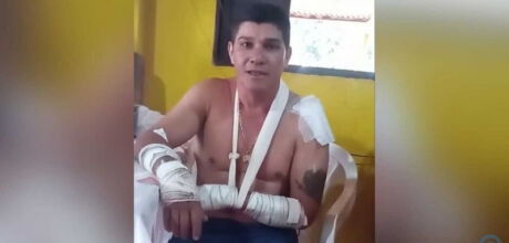 Rapaz que sobreviveu a ataque de on&ccedil;a conta experi&ecirc;ncia em Rio Verde de Mato Grosso

