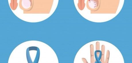 &Oacute;tima Not&iacute;cia: Cirurgia Rob&oacute;tica para C&acirc;ncer de Pr&oacute;stata Ser&aacute; Oferecida pelo SUS em At&eacute; 6 Meses
