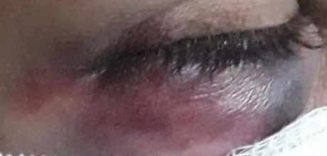 Agredida, manicure finge pedir rem&eacute;dio por telefone e filho aciona a pol&iacute;cia em MS