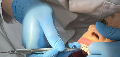 SUS garante atendimento odontol&oacute;gico gratuito e amplia servi&ccedil;os em Mato Grosso do Sul