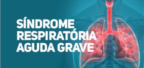 Casos de s&iacute;ndrome respirat&oacute;ria grave aumentam e acendem alerta para doen&ccedil;as respirat&oacute;rias