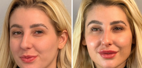 Ap&oacute;s pol&ecirc;mica com Vini Jr. e Virginia, influencer investe no visual