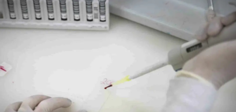 Secretaria de Sa&uacute;de de SP investiga novo caso suspeito de ebola