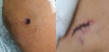 'Me afoguei no pr&oacute;prio sangue', diz sargento ferido em confronto policial em MS