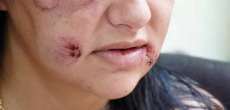 Viol&ecirc;ncia contra a mulher avan&ccedil;a em Mato Grosso do Sul e les&otilde;es em ambiente dom&eacute;stico crescem 20%