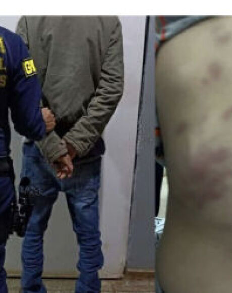 Crian&ccedil;a de 3 anos &eacute; brutalmente espancada pelo padrasto em MS