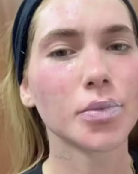 Virginia faz tratamento de pele e exibe cicatriz do parto. Veja!
