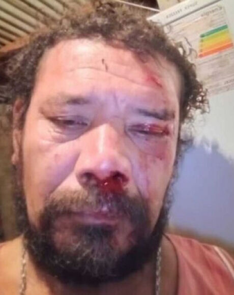 'Estou todo dolorido', diz homem atacado por on&ccedil;a ao tentar defender cachorro em Corumb&aacute;
