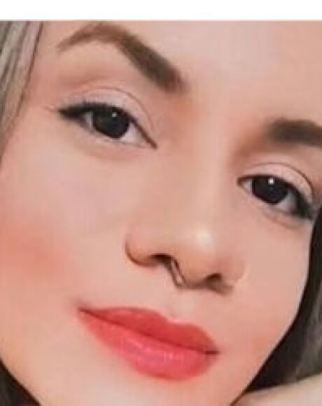 'Os ossos da minha face est&atilde;o quebrados', diz mulher agredida por ex
