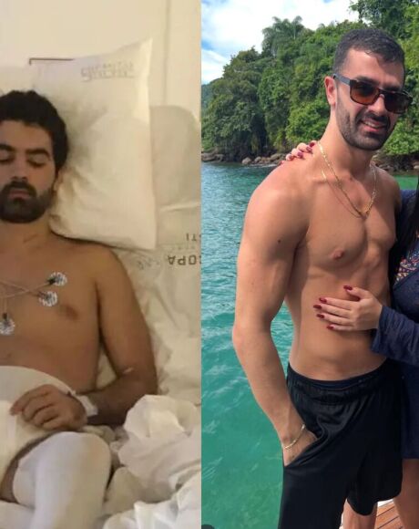 Pesquisa brasileira devolve movimentos a pacientes parapl&eacute;gicos e coloca o pa&iacute;s na vanguarda da medi