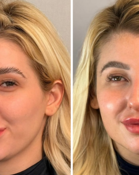 Ap&oacute;s pol&ecirc;mica com Vini Jr. e Virginia, influencer investe no visual