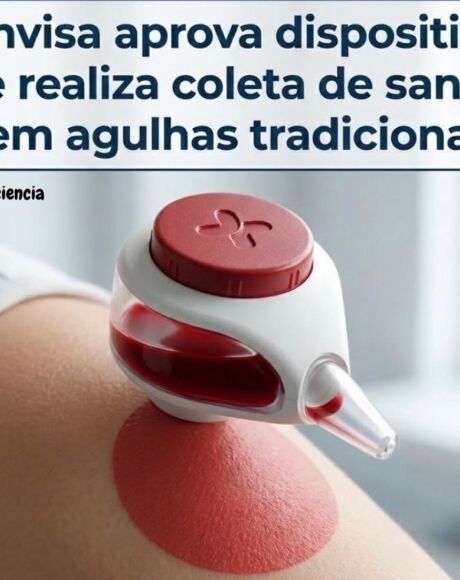 Fim da picada? Nova tecnologia aprovada pela Anvisa promete coleta de sangue sem agulhas