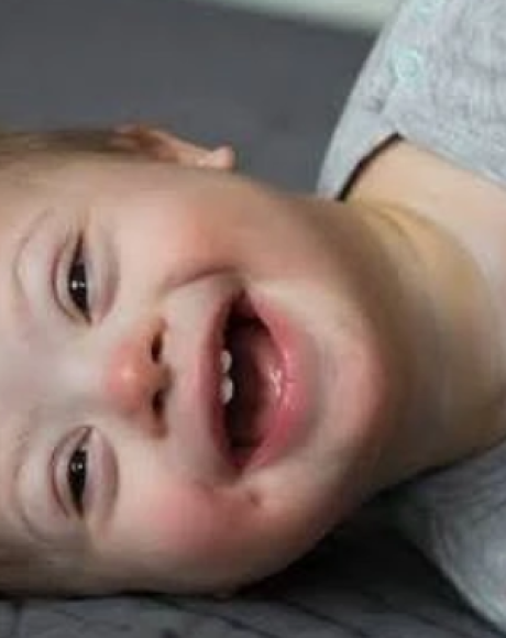 Curso gratuito da SES capacita fam&iacute;lias e profissionais para o cuidado &agrave; pessoa com s&iacute;ndrome de Down