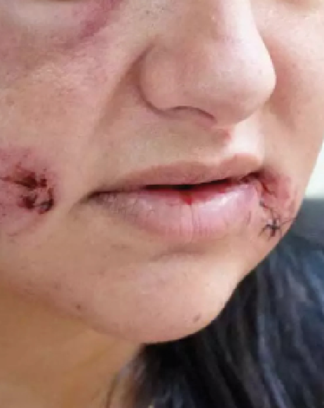 Viol&ecirc;ncia contra a mulher avan&ccedil;a em Mato Grosso do Sul e les&otilde;es em ambiente dom&eacute;stico crescem 20%