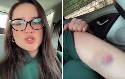 ***Juliette Freire assustou seus seguidores, ontem, 31 de outubro, ao usar as redes sociais para mostrar partes de seu corpo repletos de hematomas. A cantora e ex-BBB contou como tudo aconteceu. &ldquo;Foi mara esses dias. T&ocirc; rouca, me diverti demais com minhas amigas, com minha fam&iacute;lia&rdquo;, contou a ex-BBB. foto:REPRODU&Ccedil;&Atilde;O/INSTAGRAM