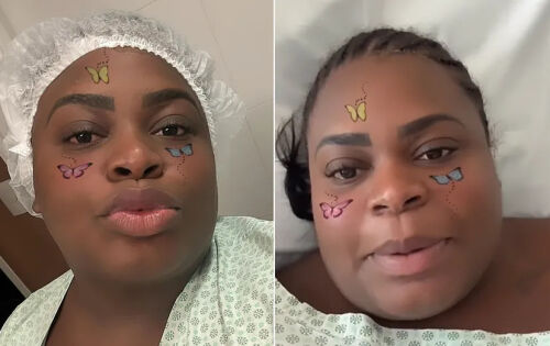***Jojo Todynho, que fez uma cirurgia bari&aacute;trica na ter&ccedil;a-feira (8), atualizou os f&atilde;s sobre seu estado de sa&uacute;de, nesta quarta (9). &ldquo;Estou bem&rdquo;, disse ela em v&iacute;deo gravado no leito do hospital na Zona Oeste do Rio onde fez a opera&ccedil;&atilde;o. A cantora de 26 anos tranquilizou os seguidores, disse que sentiu muita dor ap&oacute;s o procedimento e que j&aacute; est&aacute; fora do CTI, explicando tamb&eacute;m porque tinha dito nas redes que tinha desistido da cirurgia. &ldquo;Sempre em busca do melhor pra mim&rdquo;, escreveu Jojo. (Carolina Rocha)