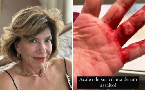 ***O domingo, 14 de abril, foi de terror para Silvia Poppovic. A apresentadora usou as redes sociais neste domingo para compartilhar uma experi&ecirc;ncia traum&aacute;tica. Ela foi v&iacute;tima de um assalto violento bem na esquina de sua casa, em S&atilde;o Paulo. Silvia descreveu o ataque em detalhes, incluindo o m&eacute;todo f&iacute;sico brutal usado pelo assaltante..(ofuxico)