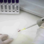 Secretaria de Sa&uacute;de de SP investiga novo caso suspeito de ebola