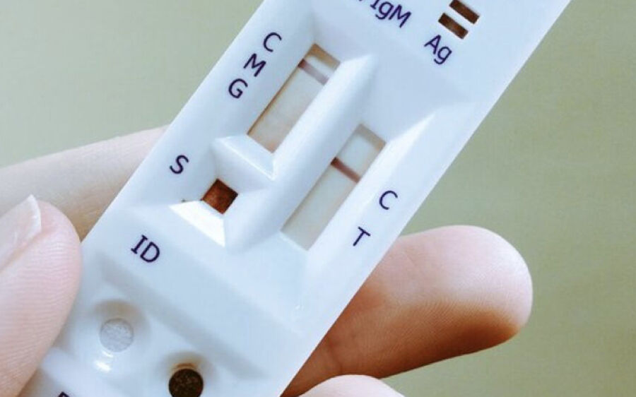 MS terá teste rápido inédito para diagnóstico de dengue na rede pública