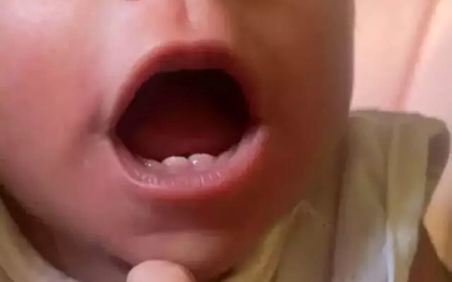 Apressada, Chloe nasceu antes do tempo e com dois dentinhos