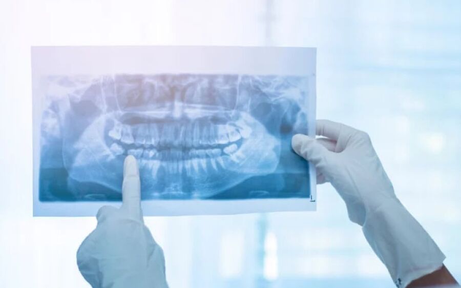 Coxim e São Gabriel e outros oito munícipios devem receber aparelhos de raio-X panorâmico
