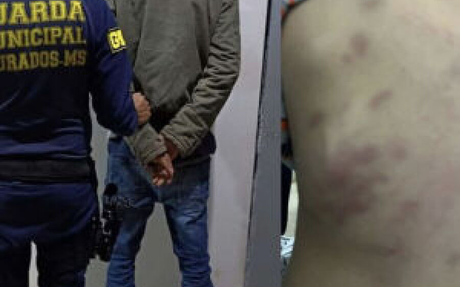 Criança de 3 anos é brutalmente espancada pelo padrasto em MS