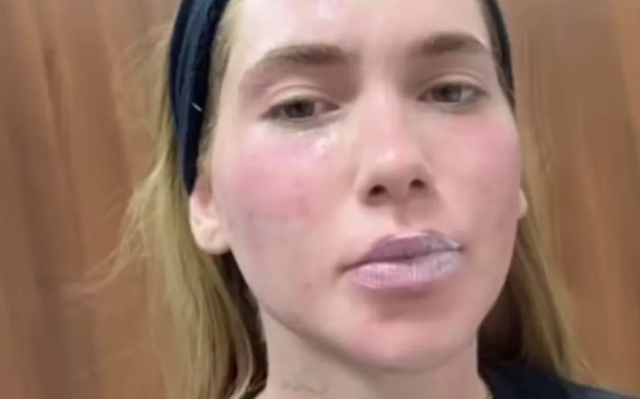 Virginia faz tratamento de pele e exibe cicatriz do parto. Veja!
