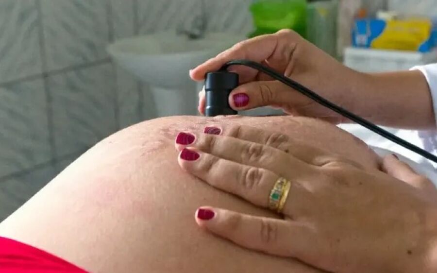 Exame pré-natal reduz chance de bebê nascer com anomalia