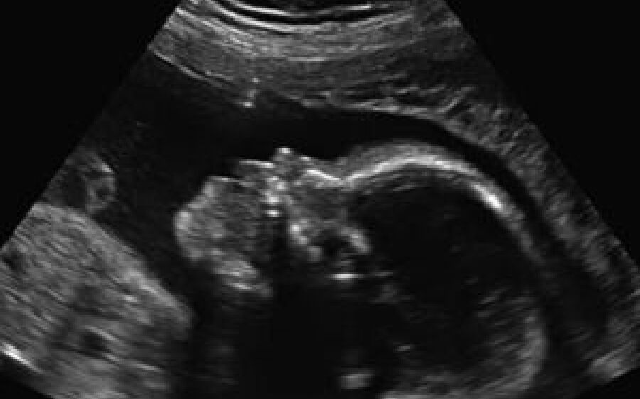 Adolescente asfixia e joga bebê prematuro no lixo ao forçar aborto