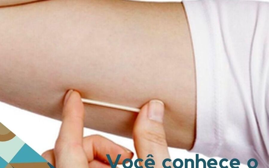 Chip contraceptivo passa a ser oferecido pelo SUS e já é utilizado em Mato Grosso do Sul