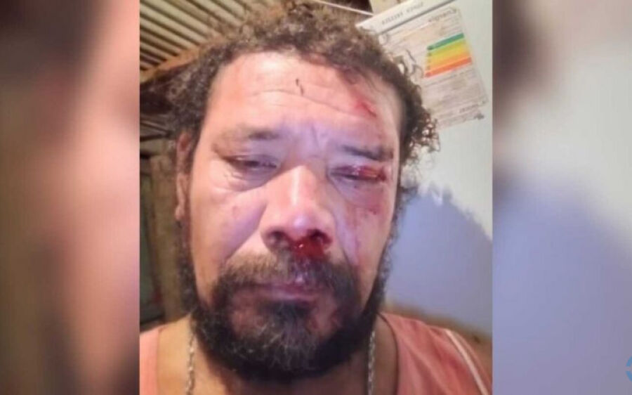 'Estou todo dolorido', diz homem atacado por onça ao tentar defender cachorro em Corumbá
