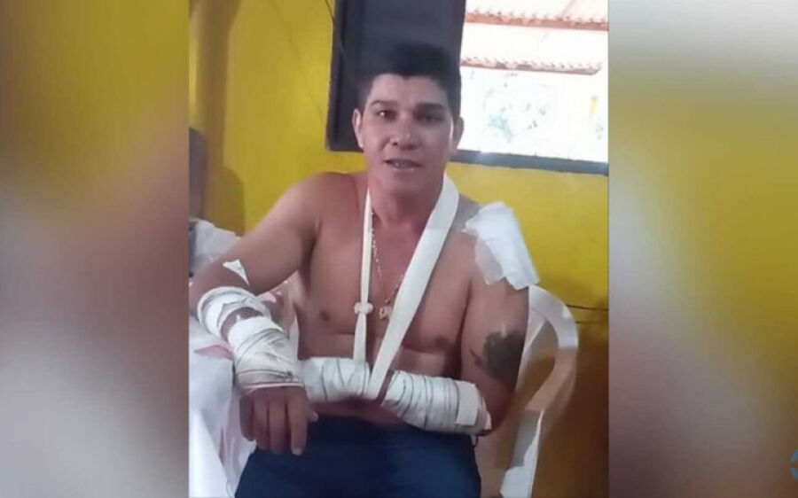 Rapaz que sobreviveu a ataque de onça conta experiência em Rio Verde de Mato Grosso
