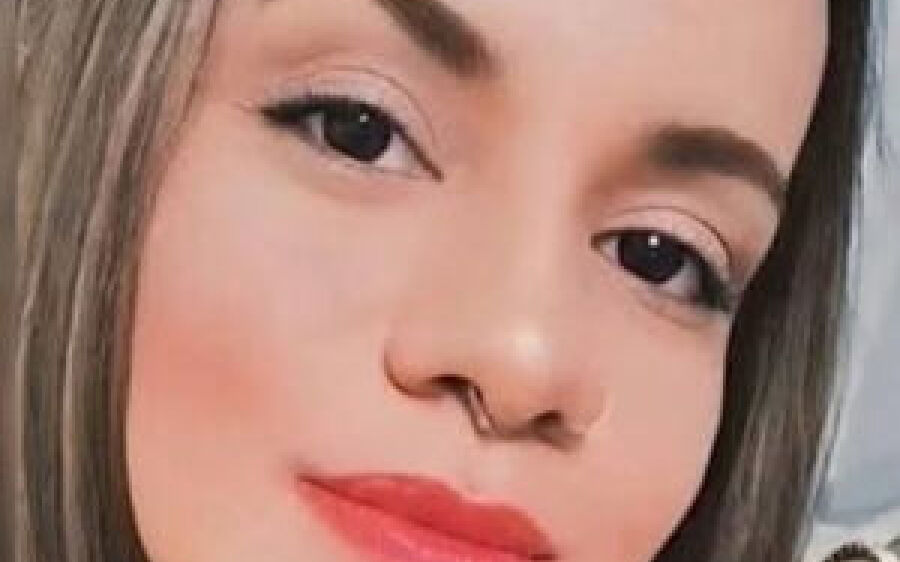 'Os ossos da minha face estão quebrados', diz mulher agredida por ex