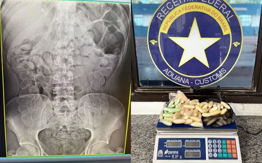 Homem com 90 cápsulas de droga no estômago é preso em operação na fronteira em MS