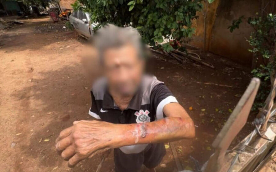 Idoso é agredido durante roubo de televisão em MS