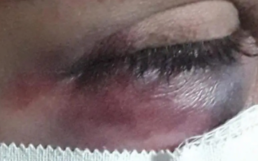 Agredida, manicure finge pedir remédio por telefone e filho aciona a polícia em MS