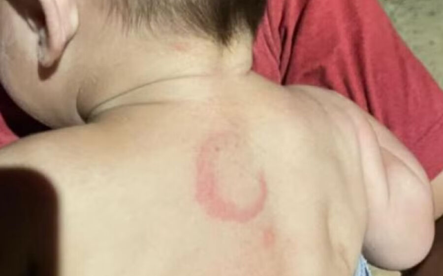 Pai acusado de espancar bebê de quatro meses tem prisão mantida em MS