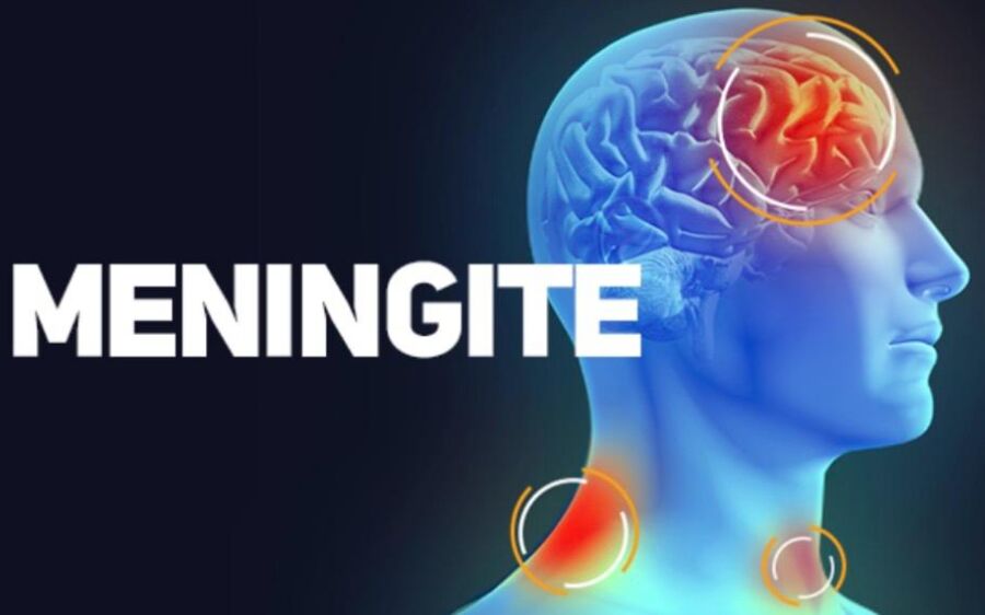 Meningite registra mortes em MS em 2026 e autoridades reforçam importância da vacinação