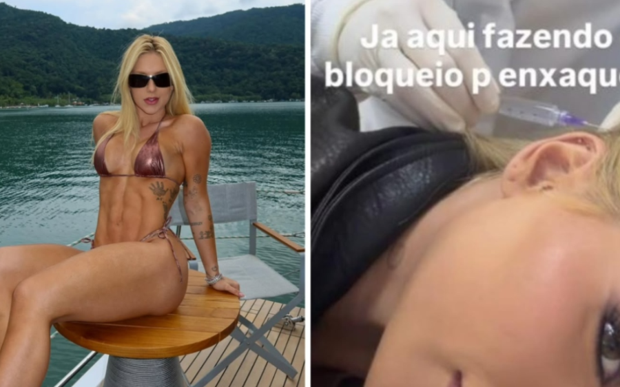 Virginia faz tratamento contra enxaqueca e especialista explica m&eacute;todo