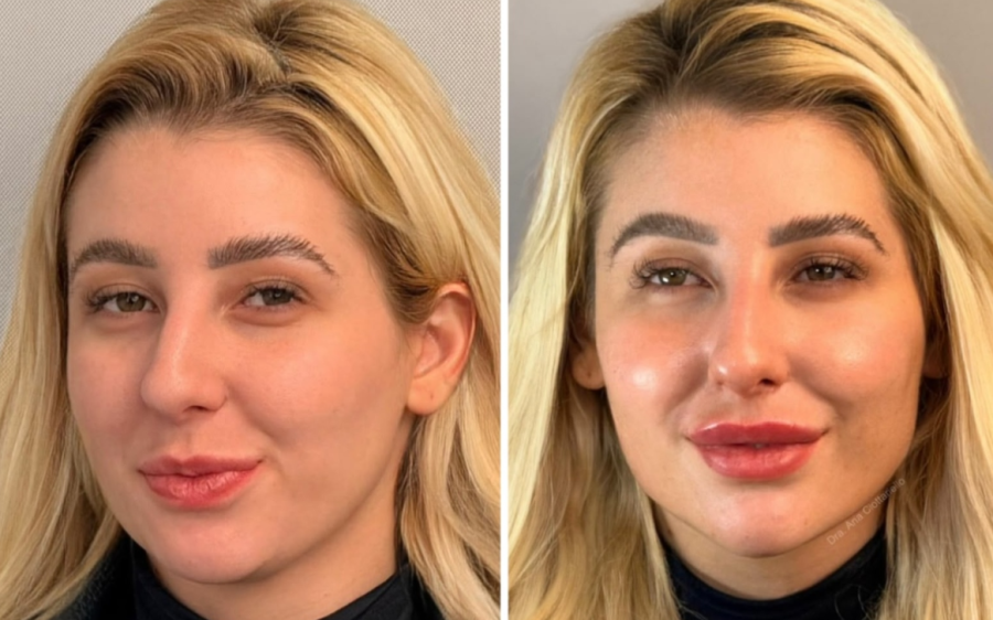 Ap&oacute;s pol&ecirc;mica com Vini Jr. e Virginia, influencer investe no visual